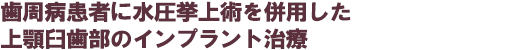 力の関与が疑われる慢性歯周炎への全顎的アプローチ