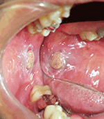 図1 初診時の口腔内所見