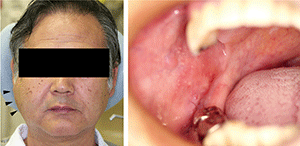図1 初診時の顔貌および口腔内写真