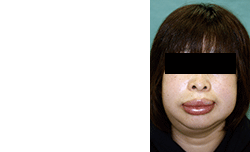 図1 初診時の顔貌写真