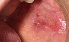 図2 初診時の口腔内写真