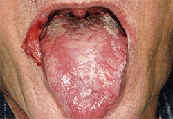 図1 初診時の舌および口角