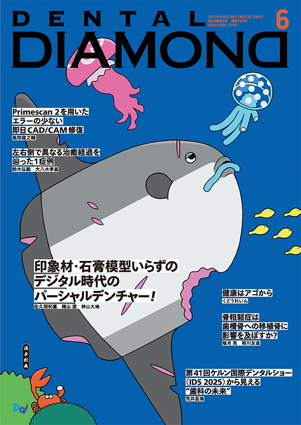 デンタルダイヤモンド 2025年6月号 表紙
