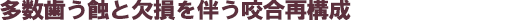 多数歯う蝕と欠損を伴う咬合再構成