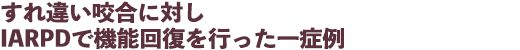 すれ違い咬合に対しIARPDで機能回復を行った一症例