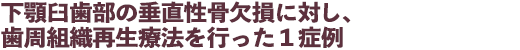 下顎臼歯部の垂直性骨欠損に対し、歯周組織再生療法を行った1症例