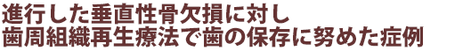 進行した垂直性骨欠損に対し歯周組織再生療法で歯の保存に努めた症例