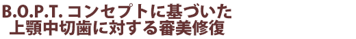 B.O.P.T. コンセプトに基づいた上顎中切歯に対する審美修復