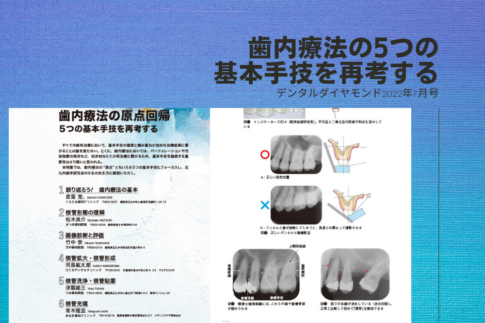 人気の中古 歯内療法関連８冊 健康/医学