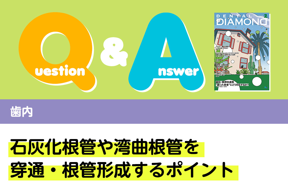 Q＆A 歯内 石灰化根管や湾曲根管を穿通・根管形成するポイント｜デンタルダイヤモンド 2024年2月号