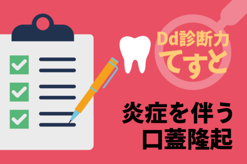 Dd診断力てすと『炎症を伴う口蓋隆起』デンタルダイヤモンド 2024年3月号