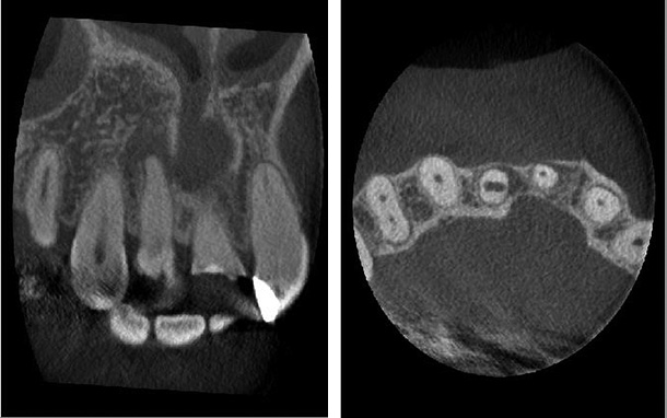 図❸　同、歯科用CT 画像