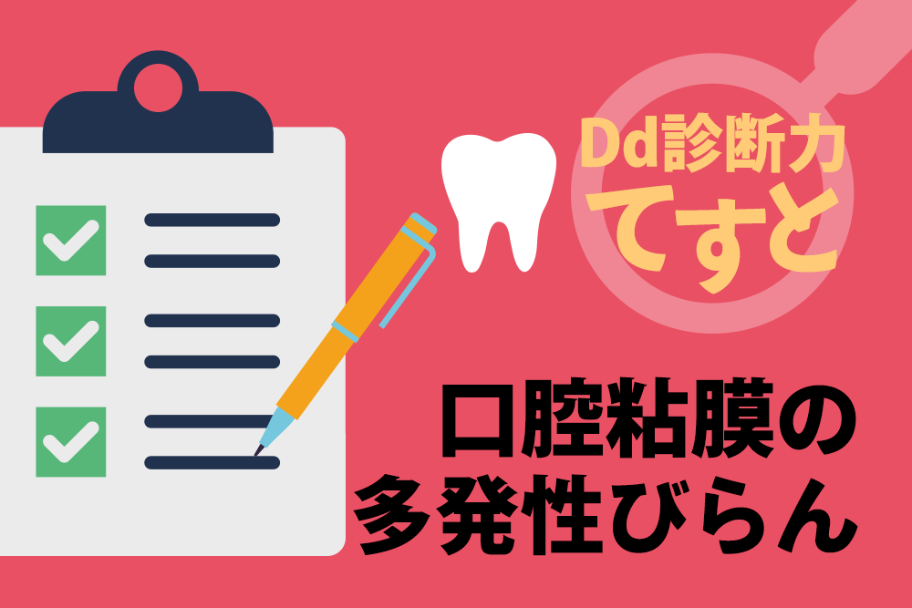 Dd診断力てすと『口腔粘膜の多発性びらん』デンタルダイヤモンド 2024年2月号