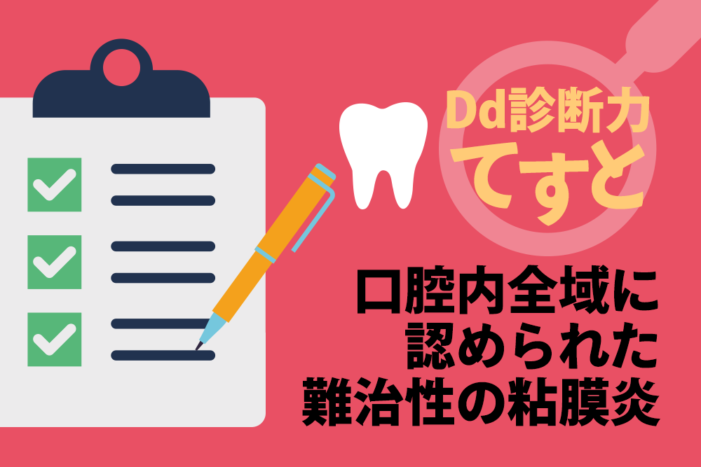 Dd診断力てすと『口腔内全域に認められた難治性の粘膜炎』デンタルダイヤモンド 2024年6月号