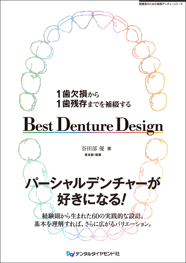 １歯欠損から１歯残存までを補綴する Best Denture Design