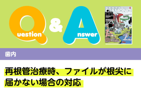 Q＆A 歯内 再根管治療時、ファイルが根尖に届かない場合の対応｜デンタルダイヤモンド 2024年1月号