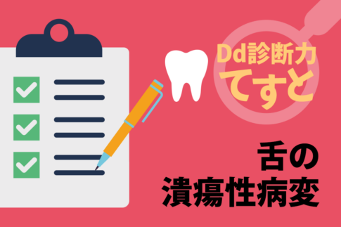 Dd診断力てすと『舌の潰瘍性病変』デンタルダイヤモンド 2024年9月号