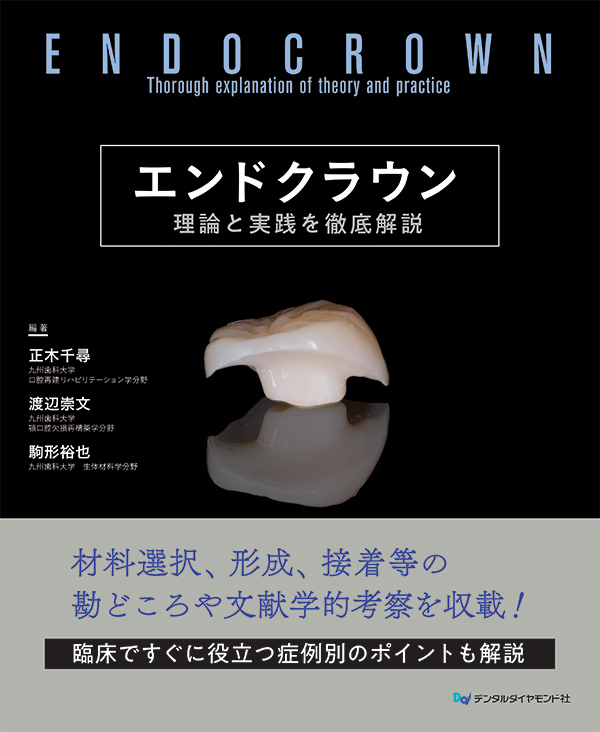 エンドクラウン　理論と実践を徹底解説　表紙