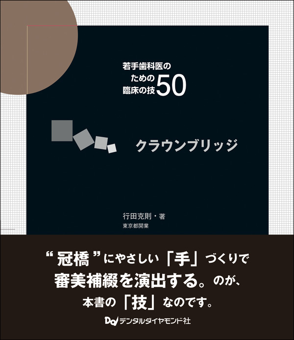 若手歯科医のための臨床の技50・クラウンブリッジ