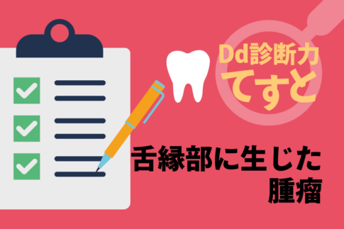 Dd診断力てすと『舌縁部に生じた腫瘤』デンタルダイヤモンド 2024年10月号