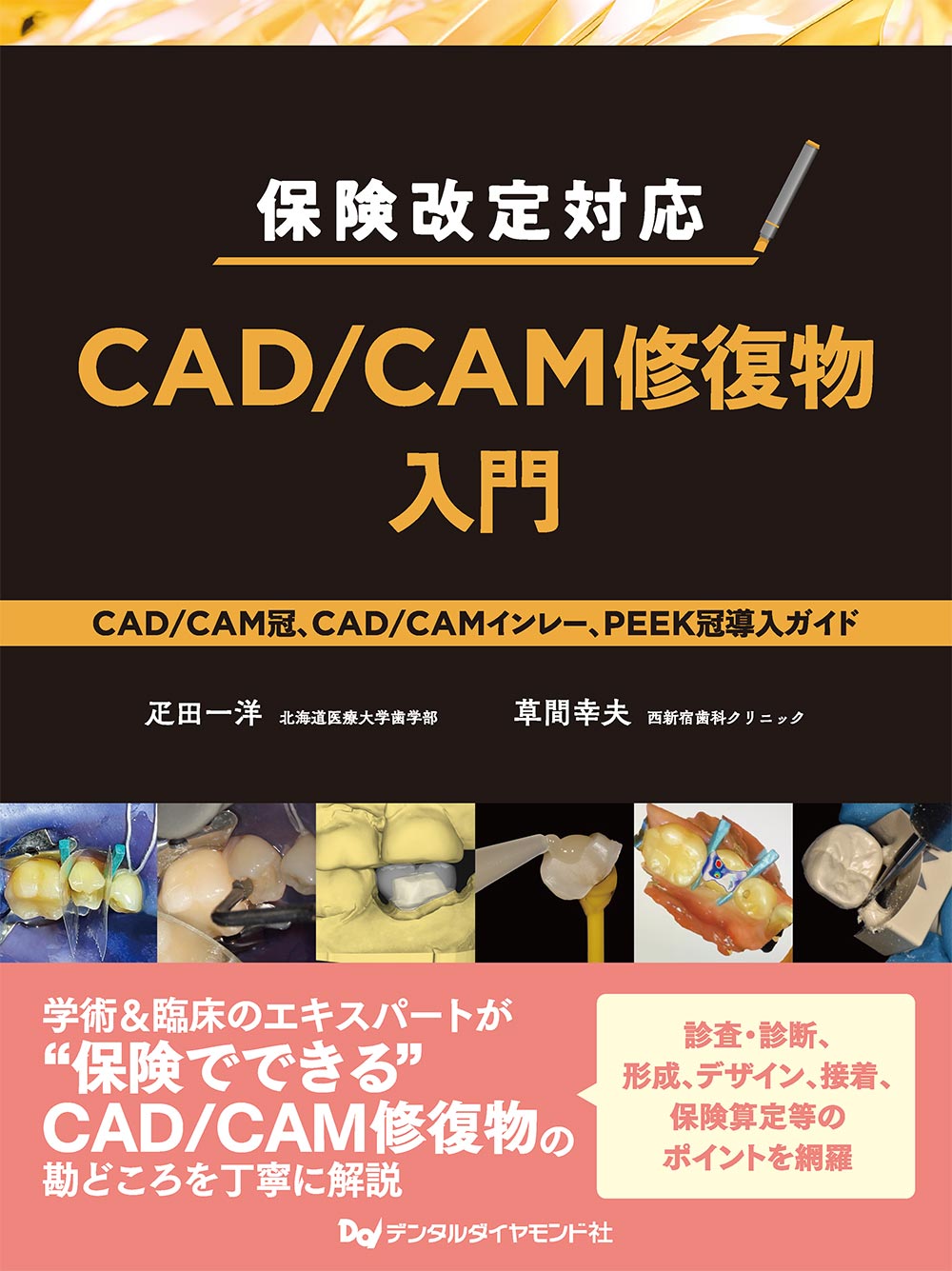 保険改定対応 CAD/CAM修復物入門　CAD/CAM冠、CAD/CAMインレー、PEEK冠導入ガイド　表紙