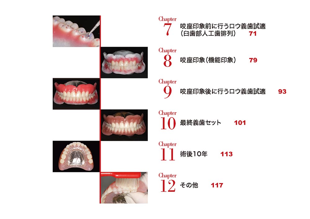 DENTURE 1st book 増補改訂版　ビジュアルでわかる総義歯製作“超”入門　もくじ