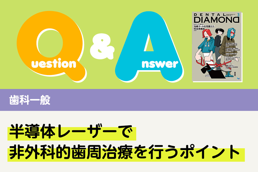 Q＆A 歯科一般 半導体レーザーで非外科的歯周治療を行うポイント｜デンタルダイヤモンド 2025年3月号