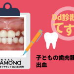 Dd診断力てすと『子どもの歯肉腫脹と出血』デンタルダイヤモンド 2025年5月号