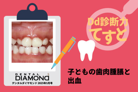 Dd診断力てすと『子どもの歯肉腫脹と出血』デンタルダイヤモンド 2025年5月号