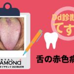 Dd診断力てすと『舌の赤色病変』デンタルダイヤモンド 2025年6月号