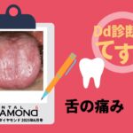 Dd診断力てすと『舌の痛み』デンタルダイヤモンド 2025年6月号