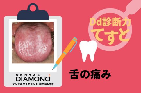 Dd診断力てすと『舌の痛み』デンタルダイヤモンド 2025年6月号
