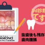 Dd診断力てすと『抜歯後も残存する歯肉腫脹』デンタルダイヤモンド 2025年5月号