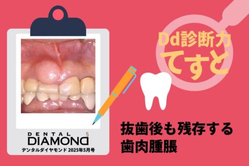 Dd診断力てすと『抜歯後も残存する歯肉腫脹』デンタルダイヤモンド 2025年5月号
