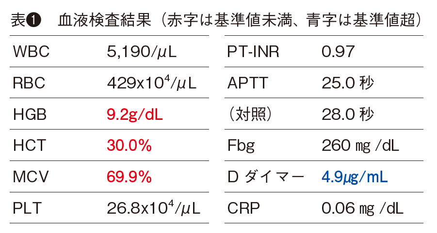 表❶ 血液検査結果(赤字は基準値未満、青字は基準値超)