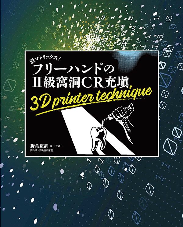 脱マトリックス！フリーハンドのII級窩洞CR充塡　3D printer technique