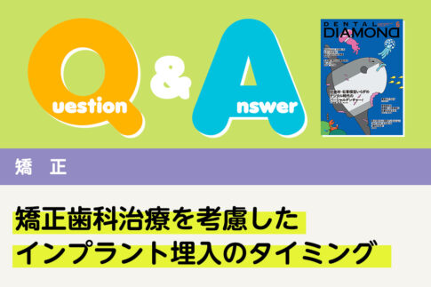 Q＆A 矯正 矯正歯科治療を考慮したインプラント埋入のタイミング｜デンタルダイヤモンド 2025年6月号