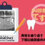 Dd診断力てすと『再発を繰り返す下顎臼歯部歯肉の腫脹』デンタルダイヤモンド 2025年7月号