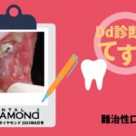 Dd診断力てすと『難治性口内炎』デンタルダイヤモンド 2025年8月号