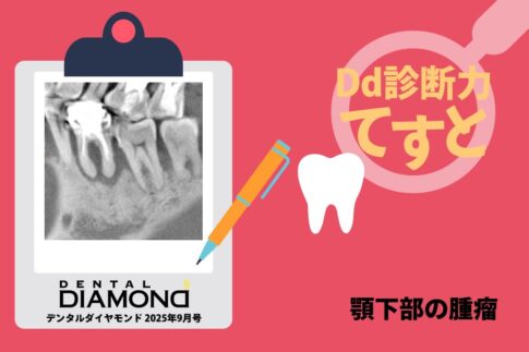 Dd診断力てすと『顎下部の腫瘤』デンタルダイヤモンド 2025年9月号