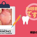 Dd診断力てすと『頰部の腫脹』デンタルダイヤモンド 2025年9月号