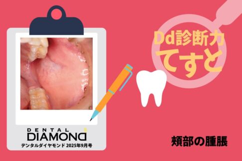 Dd診断力てすと『頰部の腫脹』デンタルダイヤモンド 2025年9月号