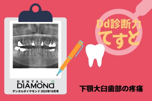 Dd診断力てすと『下顎大臼歯部の疼痛』デンタルダイヤモンド 2025年10月号