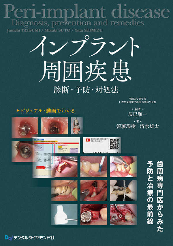【編著】
辰巳順一
(朝日大学歯学部 口腔感染医療学講座 歯周病学分野)
A4判・204頁・オールカラー
定価:16,500円(本体 15,000円+税)