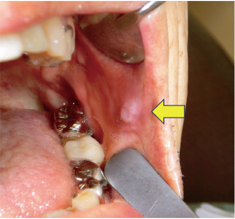 図❶ 初診時の口腔内写真