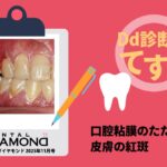 Dd診断力てすと『口腔粘膜のただれと皮膚の紅斑』デンタルダイヤモンド 2025年11月号