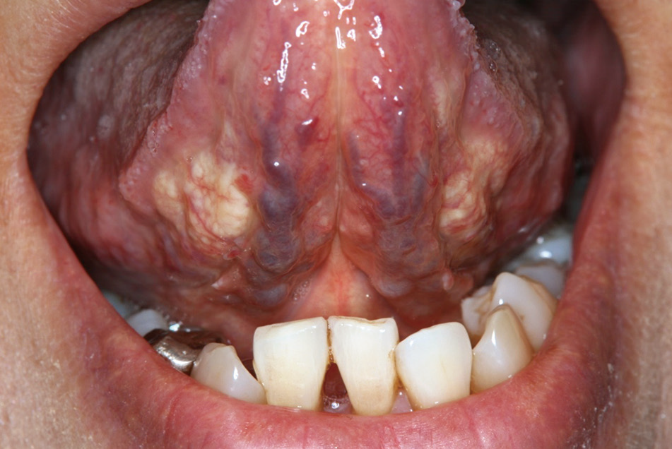 図❶ 初診時の口腔内所見