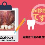 Dd診断力てすと『両側舌下面の黄白色腫瘤』デンタルダイヤモンド 2025年12月号