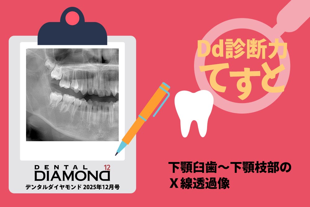 Dd診断力てすと『下顎臼歯〜下顎枝部のX線透過像』デンタルダイヤモンド 2025年12月号