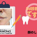 Dd診断力てすと『顔のしびれ』デンタルダイヤモンド 2026年1月号